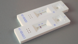 Postos de Sa&uacute;de de Jandira passam a realizar testes de Covid-19