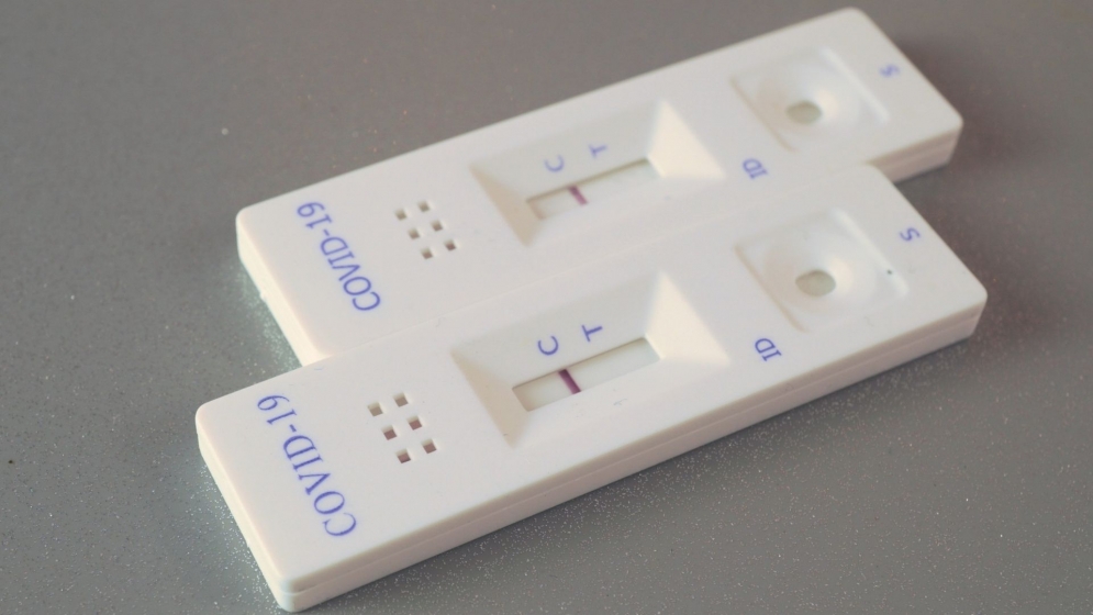 Postos de Sa&uacute;de de Jandira passam a realizar testes de Covid-19