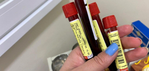 Cidade de S&atilde;o Paulo registra primeiro caso positivo para a variante Delta