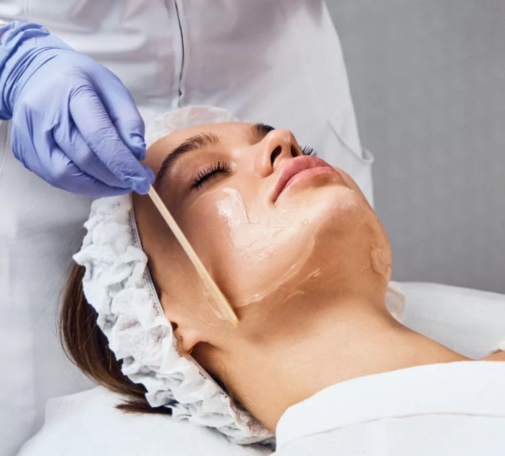 Peeling de fenol: saiba o que &eacute; e quais cuidados devem ser tomados